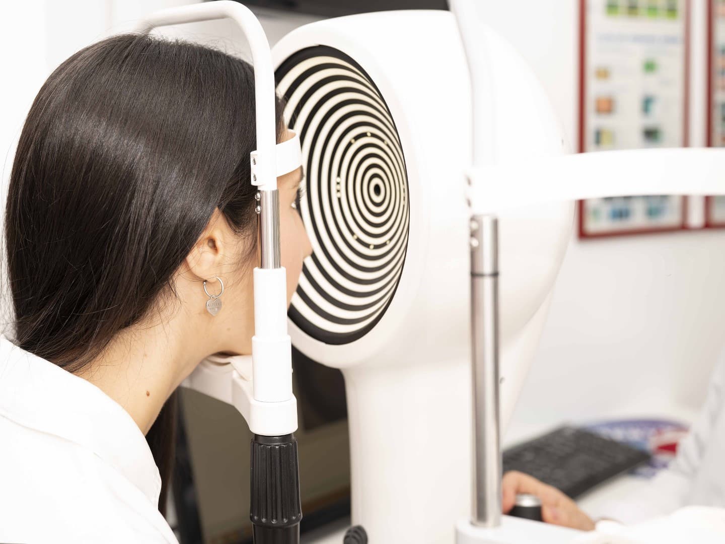 Applicazione di lenti a contatto